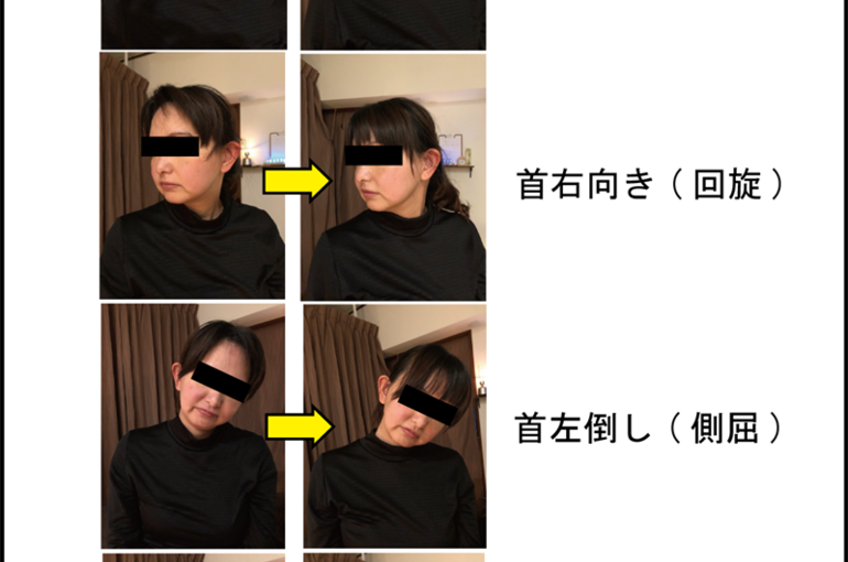 津波古さん首調整